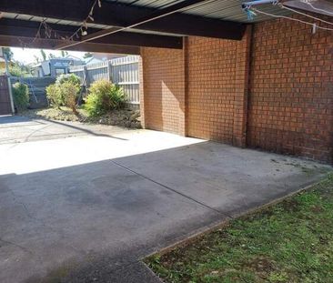 1/12 Oriel Road, Ivanhoe - Photo 5