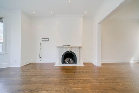 For Lease - 37 Birch Avenue, Toronto, Ontario - Photo 3