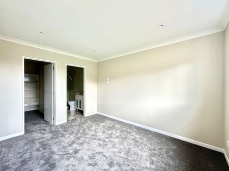 8B Kelvyn Grove, Hill Park, Auckland - Photo 4