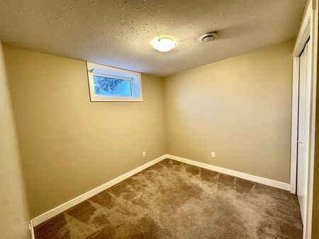 8504 152 A Avenue - Photo 3