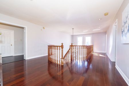 For Lease - 382 Elgin Mills Road, Richmond Hill, Ontario - Photo 5