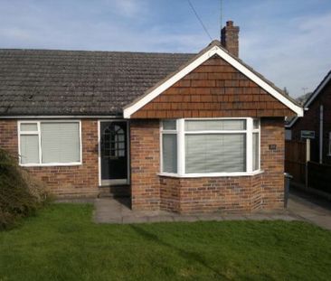 26, Springfield Drive, Forsbrook, Stoke-on-Trent, ST11 9DF. - Photo 3