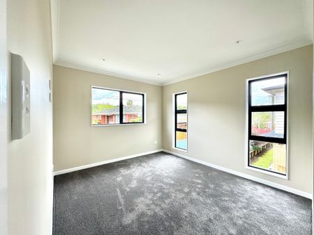 8B Kelvyn Grove, Hill Park, Auckland - Photo 5