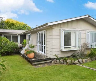 Modern 3-Bedroom Home in the Heart of Dinsdale - Photo 5