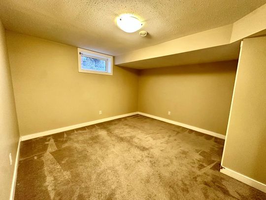 8504 152 A Avenue - Photo 1